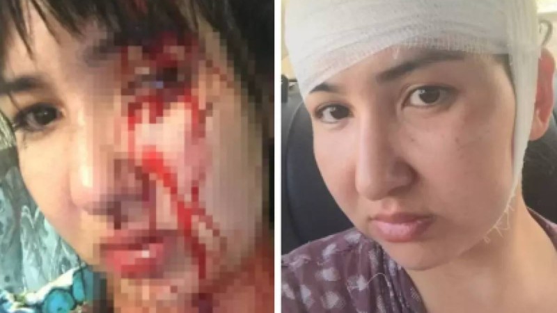 «Бетіме түкіріп, тізерлеп отырғызды». Атыраулық әйел бұрынғы депутат күйеуі 12 жыл бойы қорлағанын айтты