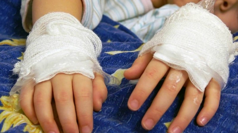 Телефон қуаттағышты тістеген 6 айлық нәресте өлім аузынан қалды - Қазақстан жаңалықтары