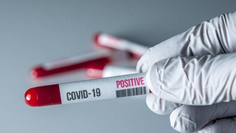 Қазақстанда коронавирус жұқтырғандардың саны 2652 науқас болды - Қазақстан жаңалықтары