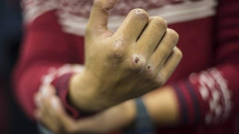 Шешенстан полициясы экс-басшысының Қазақстанда соққыға жығылғаны рас па?