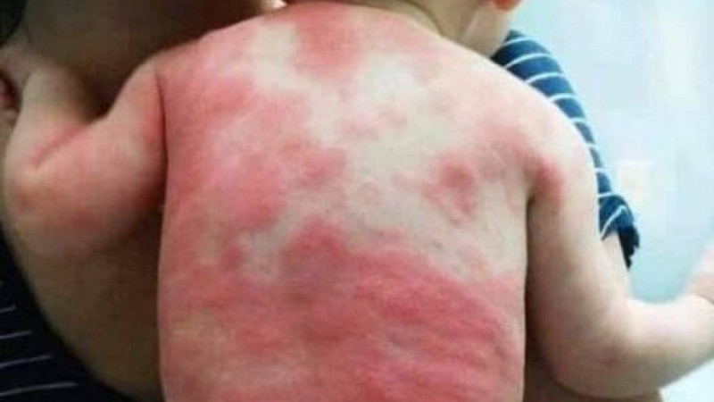 "Вакцина салған соң" түсірілген сурет қазақстандықтарды шошытты