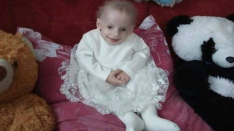 8 жасар бүлдіршін кәріліктен көз жұмды - Қазақстан жаңалықтары