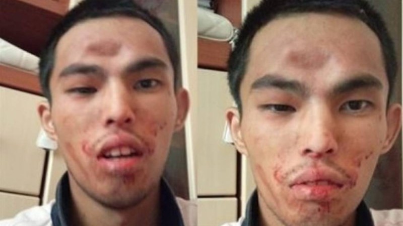 Алматыда әкесі баласын намаз оқымағаны үшін әбден ұрып, жансақтау бөлімінен бір-ақ шығарған