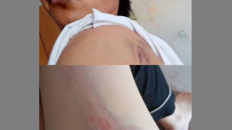 "Бәрі көк ала қойдай таяқ жеген": Белгілі заңгер елдегі қорғансыз әйелдерге араша түсті