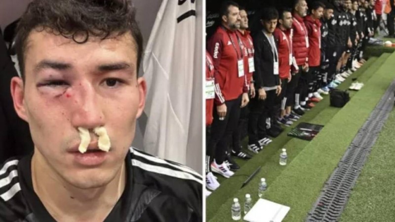 Қазақстандық футболшы Бақтияр Зайнутдинов ауыр жарақат алып, ауруханаға түсті