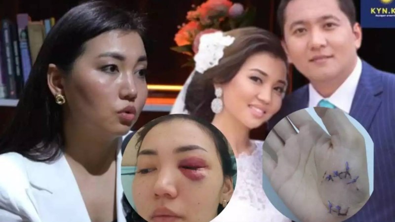 «Айғанымның түрін көріп шошып кеттім»: Меруерт Түсіпбаева журналист Асхат Садырбайдың бұрынғы әйелі туралы