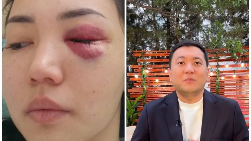 “Көзім ағып кете жаздады” - Асхат Садырбайдың экс-әйелі күйеуінен көрген қорлығын жайып салды