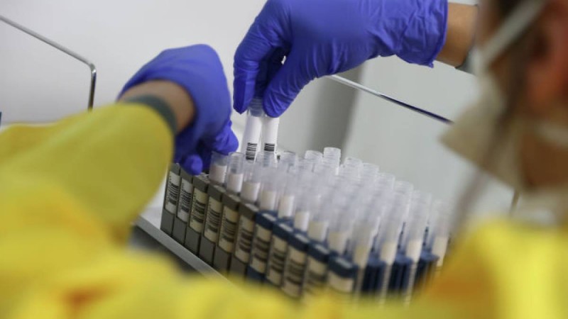 Қазақстанда тағы 77 адамда COVID-19 расталды