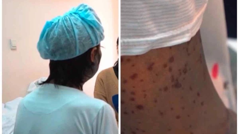 TikTok-та жарнамаланған дәріні ішкен шымкенттік әйел өлім аузынан аман қалды