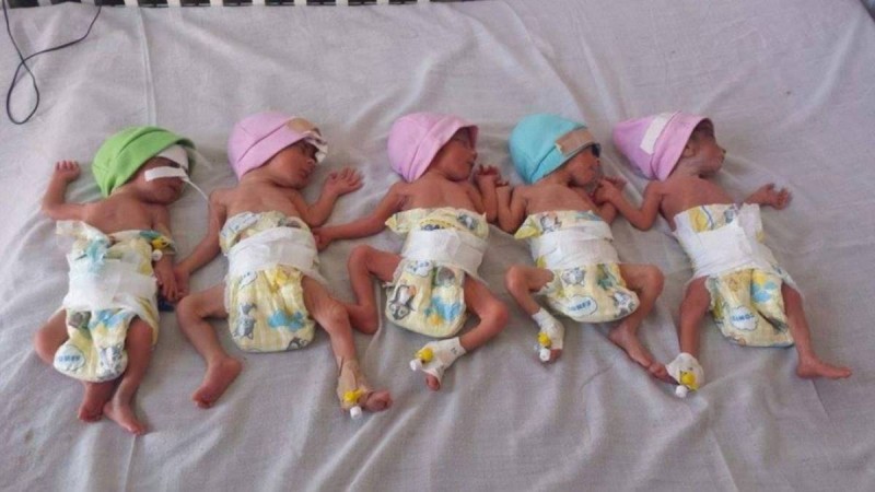 Үшінші перзентін күтіп жүрген әйел бірден 5 бала туды