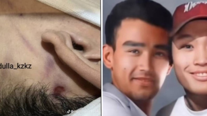 "Денесінде іздер бар": Адвокат Шерзаттың ағасының өліміне қатысты тың деректермен бөлісті