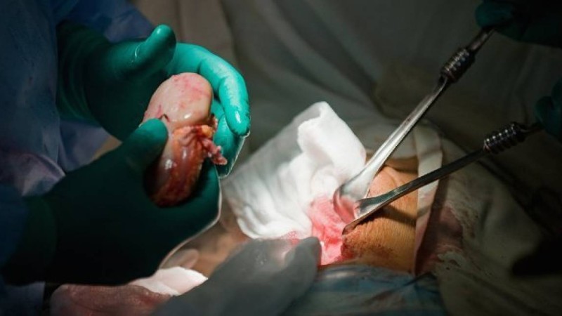 Президент қол қойды: Қазақстанда мәйіттің сау органы қызу саудаға түсуі мүмкін