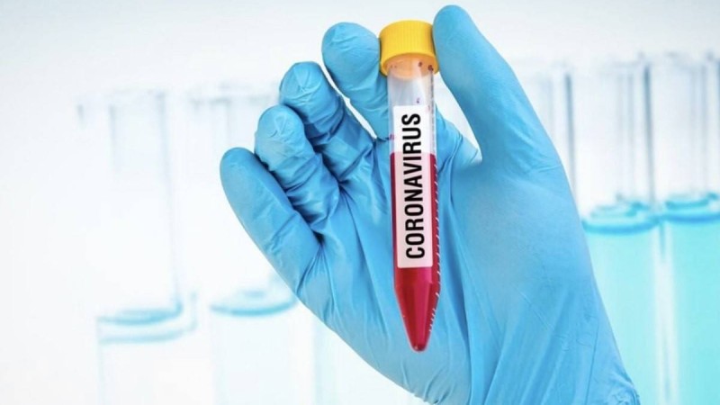 Қазақстанда COVID-19 жұқтырудың 45 жағдайы тіркелді