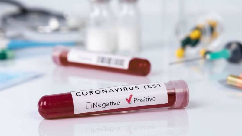 Қазақстанда коронавирус жұқтырғандарың саны 1500-ден асты - Қазақстан жаңалықтары