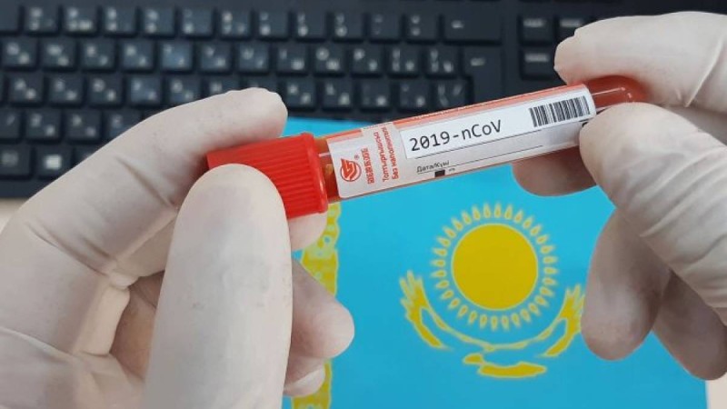 Шымкентте бір отбасының 9 адамы коронавирустан жазылды