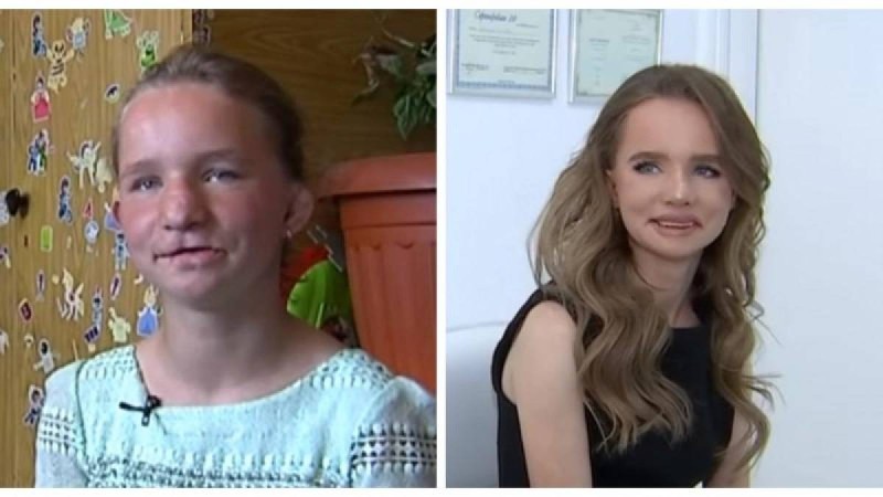 Туыстары келбетін жарақаттаған алматылық қыз адам танымастай өзгерді