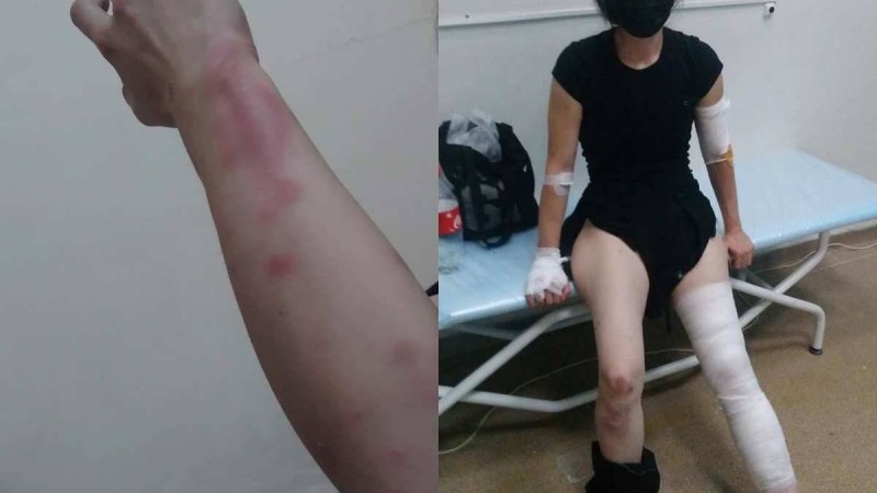 "Аяқ-қолымды сындырды": Алматылық әйел полицейлерден жәбір көргенін айтты