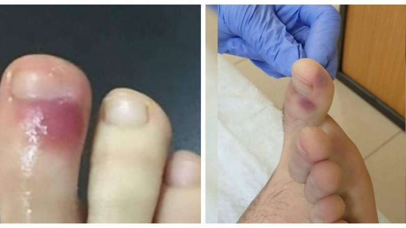 Ғалымдар коронавирустың ерекше белгісін айтты - Қазақстан жаңалықтары