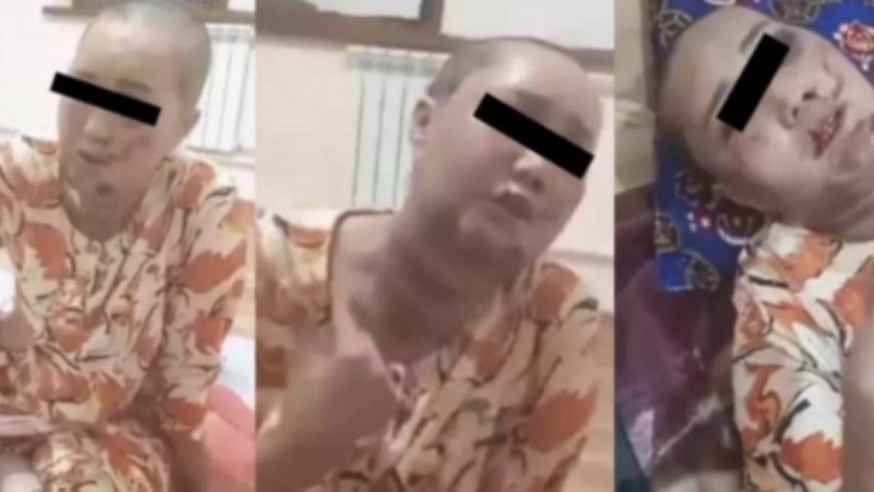 Ер адам қызғаныштан бұрынғы әйелін ұрып, шашын қырып тастаған