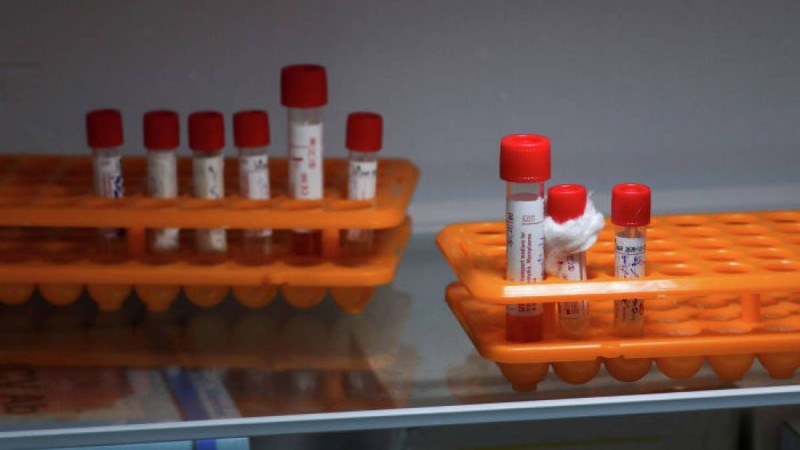 Қазақстанда тағы 13 адам коронавирустан жазылып шықты