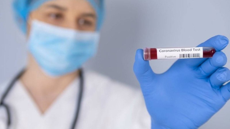 Алматы қалалық орталық клиникалық аурухананың 182 медициналық қызметкері коронавирус жұқтырған