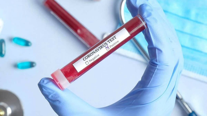 Қостанай облысында бір науқас коронавирустан көз жұмды