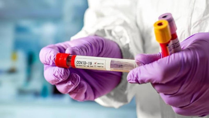 Елде бір тәулікте 1708 адам коронавирус жұқтырды