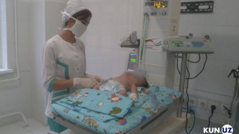 Өзбекстанда екі басы бар сәби туылды