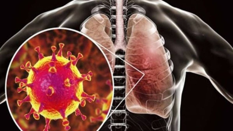Сарапшы Қазақстанда пневмонияның пайда болу себебін атады: Бұл 99% коронавирус