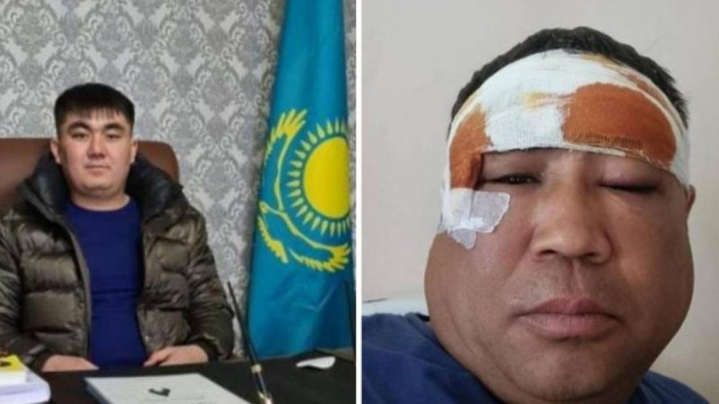 "AMANAT" партиясының депутаты фермерді соққыға жықты деп айыпталуда