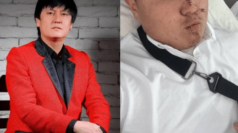 Өмірқұл Айниязовтың ұлы той алдында жол апатына түсті