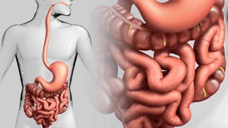 Ішек ауруларымен ауыратындар артып барады