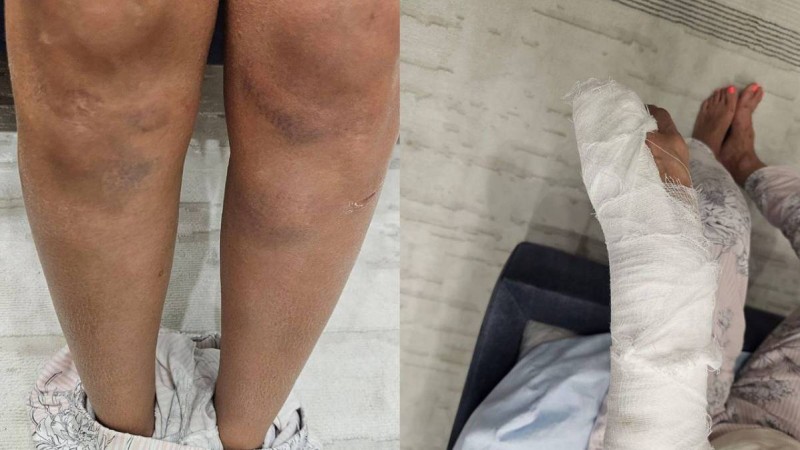 Алматы тұрғыны танымал қазақстандық спортшының соққыға жыққанын мәлімдеді