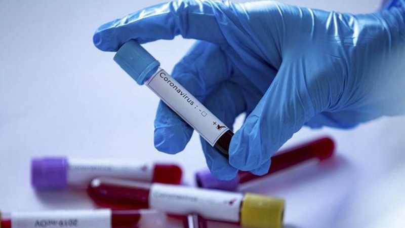 Ауруханаға жатудан бас тартқан Павлодарлық әйел коронавирустан көз жұмды - Қазақстан жаңалықтары