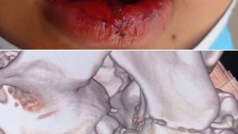 Атырауда 11-сынып оқушылары мектеп дәретханасында 10-сынып оқушысын соққыға жыққан