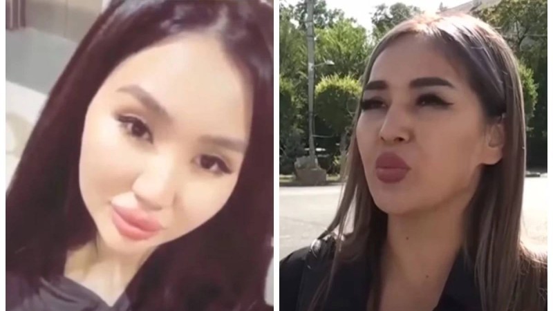 "Адам емессіңдер, жауап бересіңдер дейді": Таразда арнайы білімсіз ота жасап, сотталған косметолог жәбірленушіге хабарласып қорқытып жүр