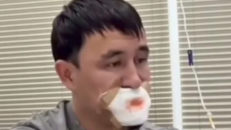 Сүйісіп, тілінен айырылған жігіт туралы тың ақпарат шықты