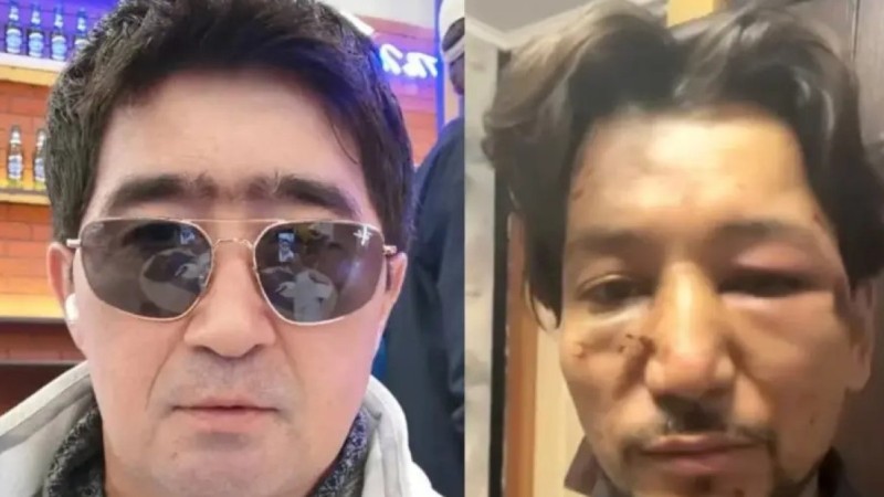 "Ғалымжанды есінен танығанша ұрған, оны алда операция күтіп тұр": Мұқасан Шахзадаевқа тықыр таянды