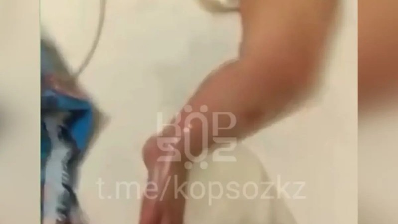 Астанада ауруханада 9 айлық сәби күйіп қалған