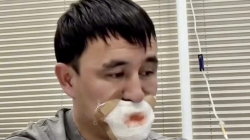 Романтика орнына трагедия: жігіт сүйісемін деп тілінен айрылып қалды