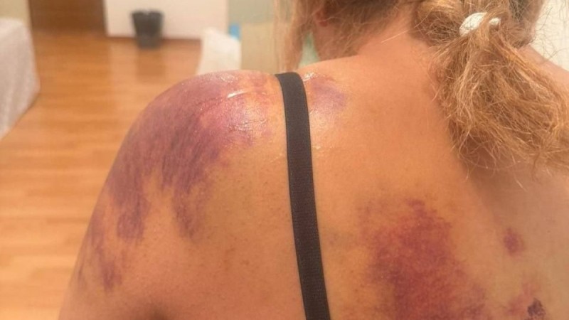 Жетісу облысында көршісін күрекпен ұрған күдікті бостандықта жүр