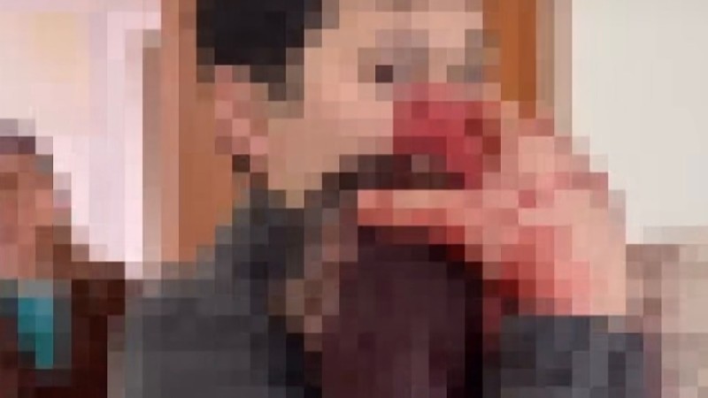 “Бас сүйегін тесіп өткен”: Басына мәдениет үйінің кірпіші құлаған 2,5 жасар сәби туралы тың ақпараттар айтылды